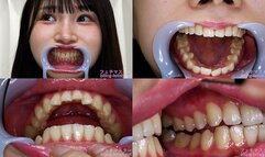 Kana Yura - Watching Inside mouth of Japanese cute girl - MOV 1080p