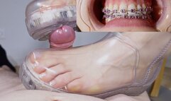 Shoejob with CLEAR UGG and BRACES