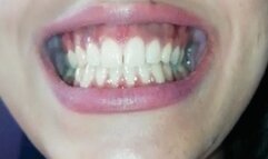 Show my mouth and teeth 12