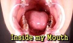 Inside my Mouth (iPhone)