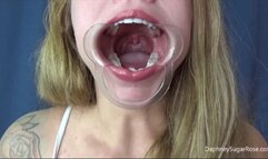 Cheek Retractor Spreading My Mouth Open Wide -Mov 1920x1080p