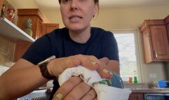 Trying to clean my fingers in my dirty arm cast