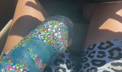 Driving my car with my arm cast