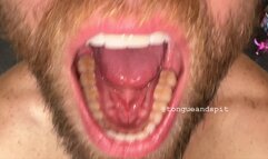 Andrew Teeth Bottom Molars and Retainer Part17 Video1 - MP4